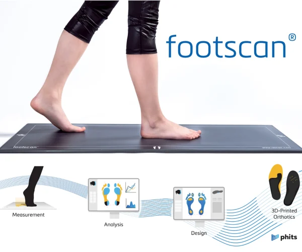 footscan treatment